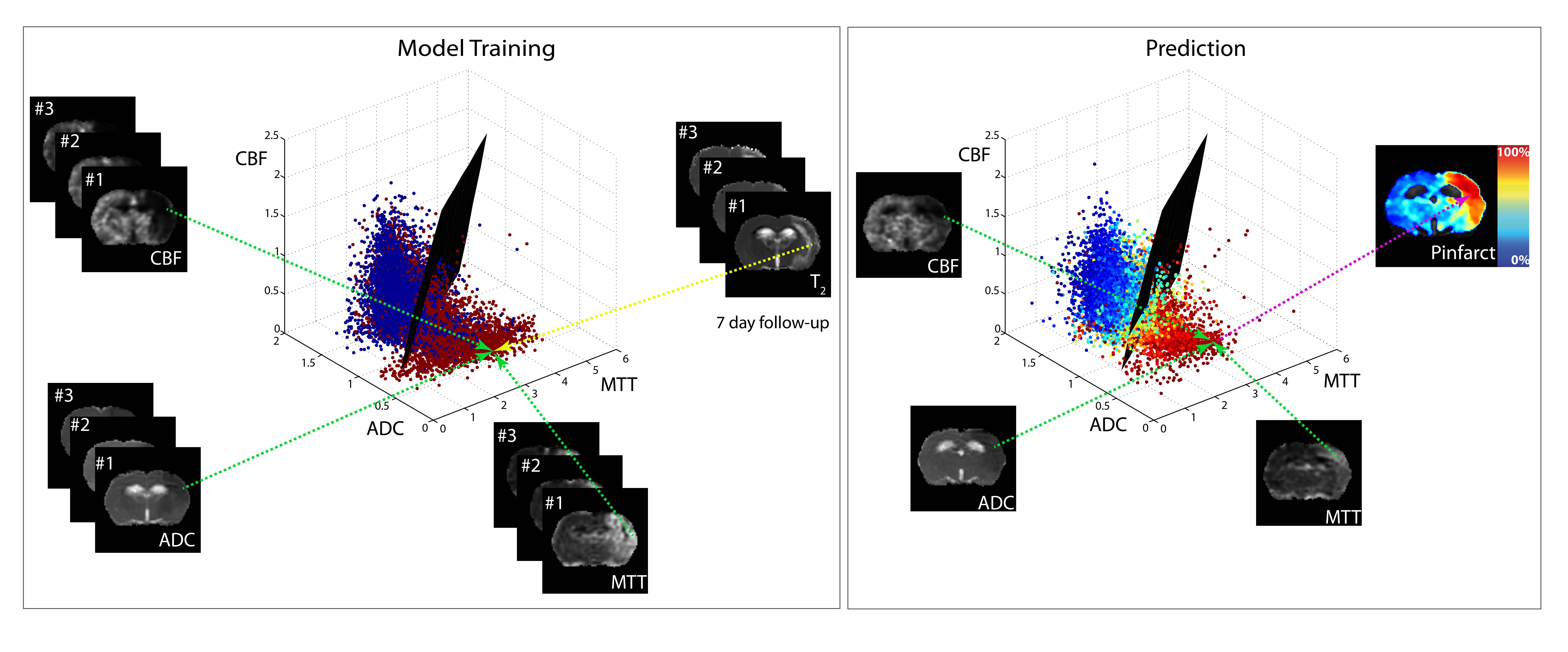 Stroke Diagnosis, Prediction And Treatment Monitoring With ...